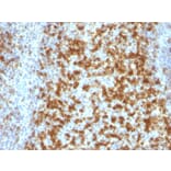 Immunohistochemistry - Anti-PD1 Antibody [PDCD1/922] - BSA and Azide free (A252765) - Antibodies.com