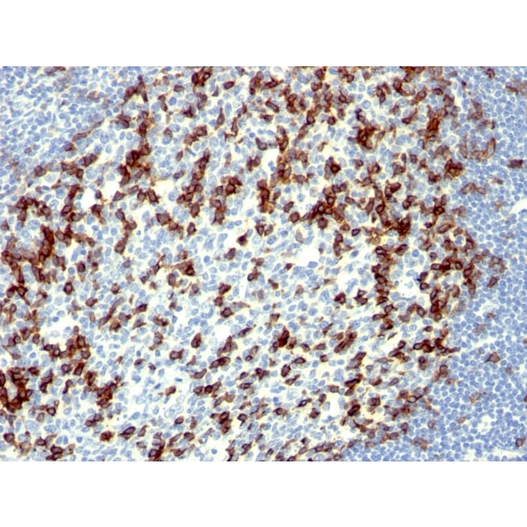 Immunohistochemistry - Anti-PD1 Antibody [NAT105] - BSA and Azide free (A252766) - Antibodies.com