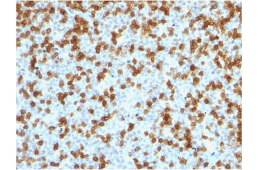 Immunohistochemistry - Anti-PD1 Antibody [PDCD1/1410R] - BSA and Azide free (A252767) - Antibodies.com