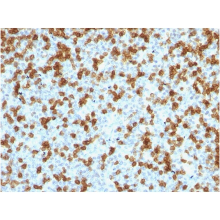 Immunohistochemistry - Anti-PD1 Antibody [PDCD1/1410R] - BSA and Azide free (A252767) - Antibodies.com