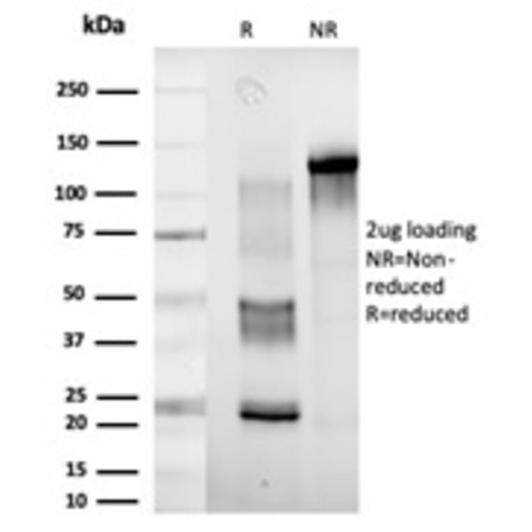 SDS-PAGE - Anti-DDX41 Antibody [PCRP-DDX41-1B4] - BSA and Azide free (A252770) - Antibodies.com