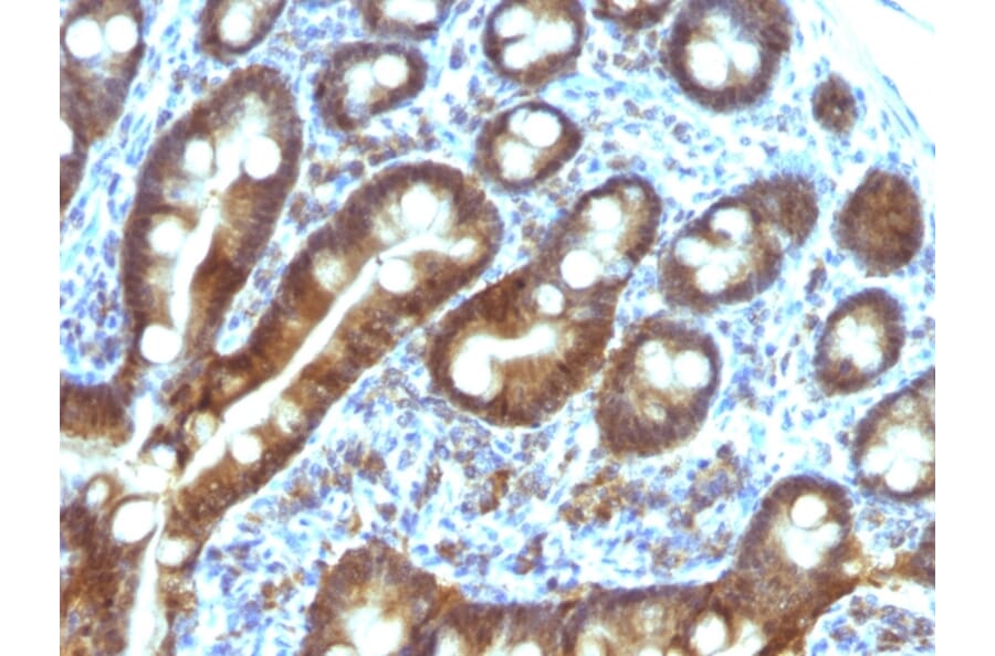 Immunohistochemistry - Anti-TDP2 Antibody [TDP2/1258] - BSA and Azide free (A252771) - Antibodies.com