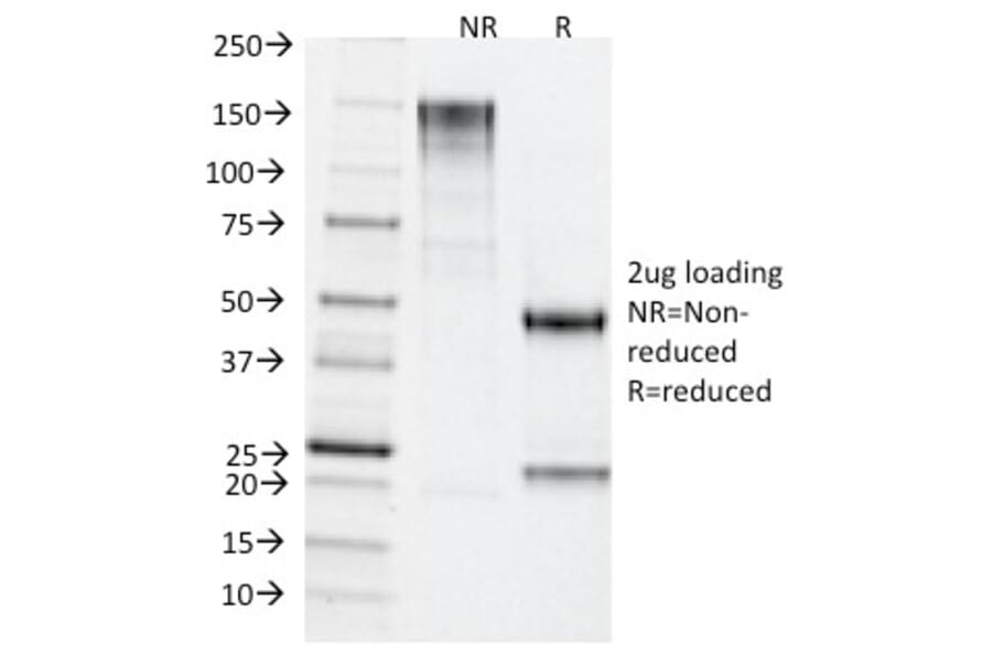 SDS-PAGE - Anti-TDP2 Antibody [TDP2/1258] - BSA and Azide free (A252771) - Antibodies.com