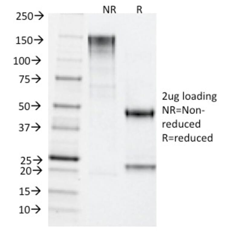 SDS-PAGE - Anti-TDP2 Antibody [TDP2/1258] - BSA and Azide free (A252771) - Antibodies.com