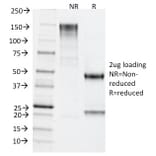 SDS-PAGE - Anti-TDP2 Antibody [TDP2/1258] - BSA and Azide free (A252771) - Antibodies.com