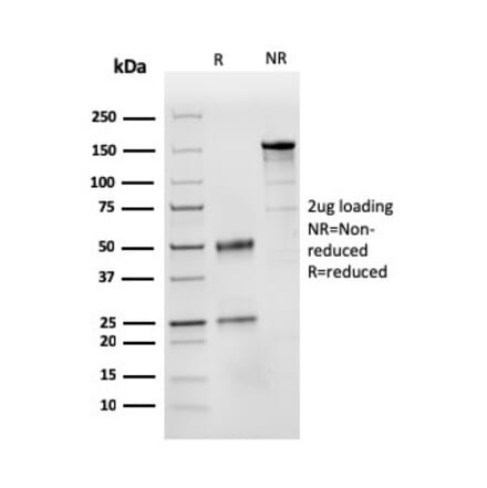 SDS-PAGE - Anti-CD31 Antibody [PECAM1/3525] - BSA and Azide free (A252774) - Antibodies.com