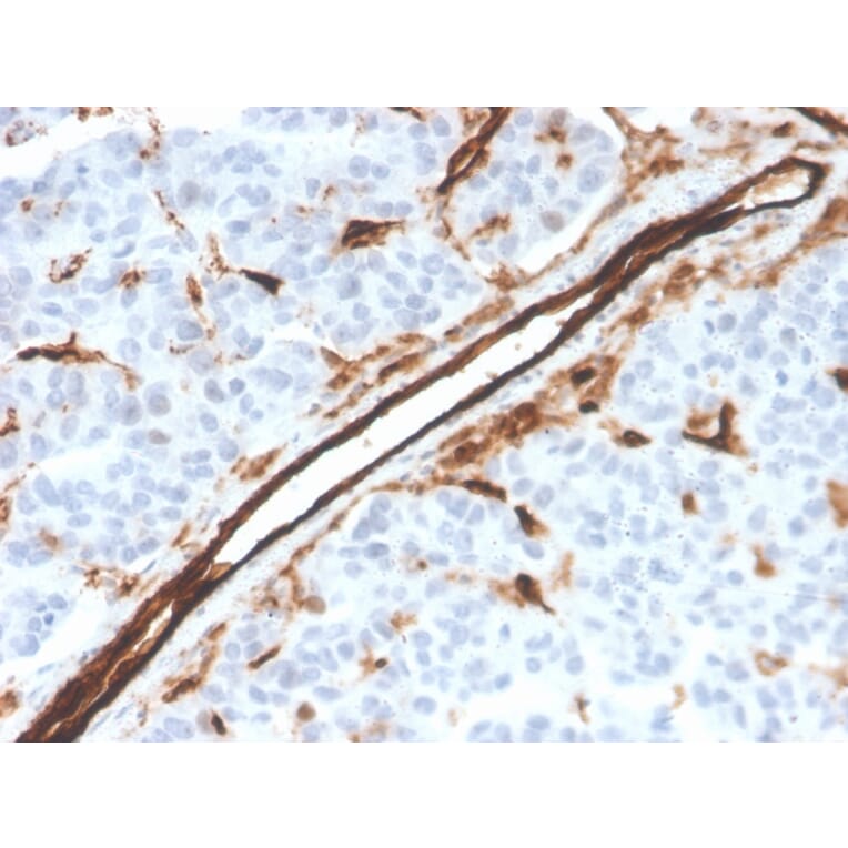 Immunohistochemistry - Anti-CD31 Antibody [PECAM1/3526] - BSA and Azide free (A252775) - Antibodies.com