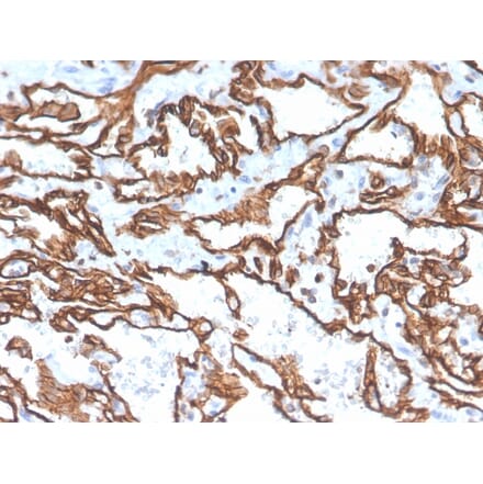 Immunohistochemistry - Anti-CD31 Antibody [PECAM1/3529] - BSA and Azide free (A252778) - Antibodies.com