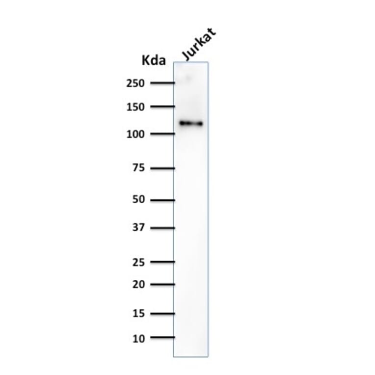 Western Blot - Anti-CD31 Antibody [SPM532] - BSA and Azide free (A252782) - Antibodies.com