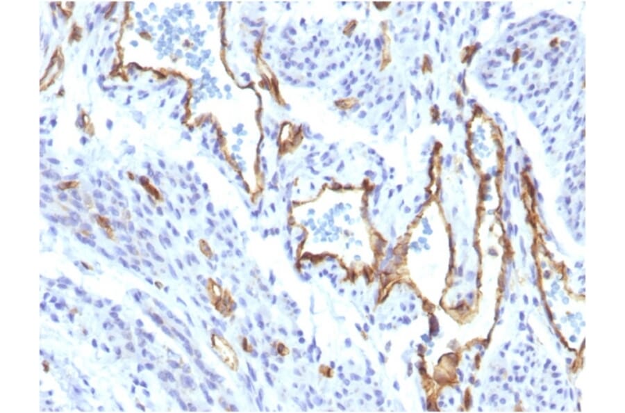 Immunohistochemistry - Anti-CD31 Antibody [C31/1395R] - BSA and Azide free (A252789) - Antibodies.com