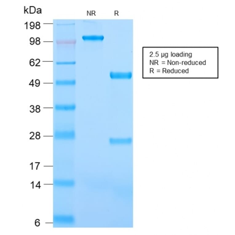 SDS-PAGE - Anti-CD31 Antibody [C31/2876R] - BSA and Azide free (A252790) - Antibodies.com