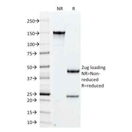SDS-PAGE - Anti-PLGF Antibody [PLGF/94] - BSA and Azide free (A252791) - Antibodies.com