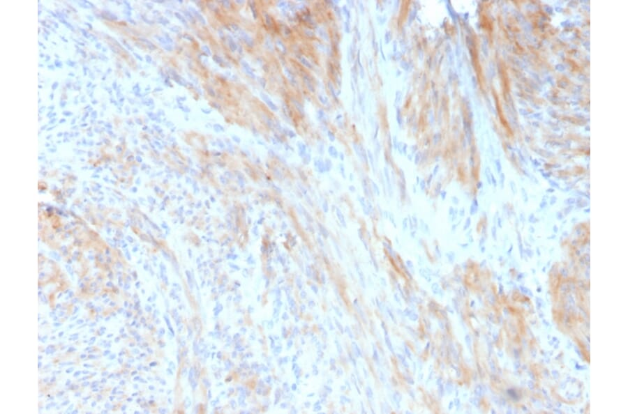 Immunohistochemistry - Anti-Phosphoglucomutase 5 Antibody [14F8/F8] - BSA and Azide free (A252794) - Antibodies.com
