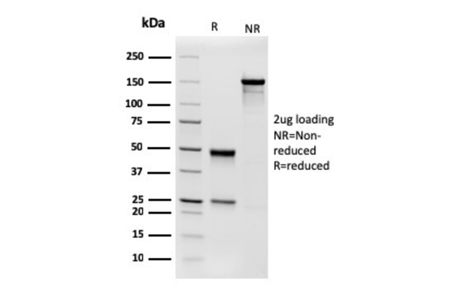 SDS-PAGE - Anti-Phosphoglucomutase 5 Antibody [14F8/F8] - BSA and Azide free (A252794) - Antibodies.com