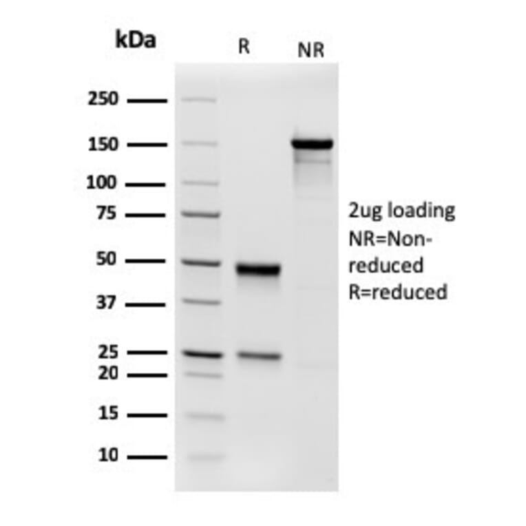 SDS-PAGE - Anti-Phosphoglucomutase 5 Antibody [14F8/F8] - BSA and Azide free (A252794) - Antibodies.com