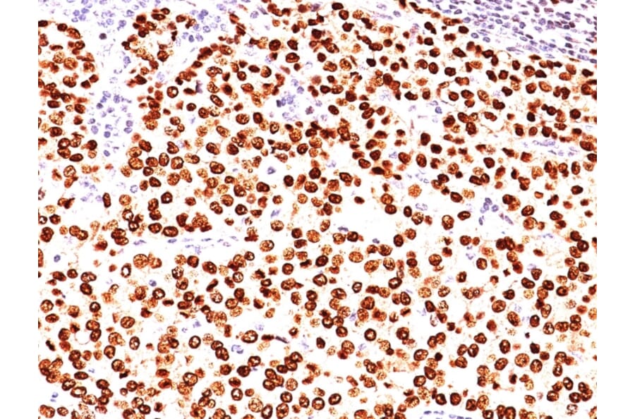 Immunohistochemistry - Anti-Progesterone Receptor Antibody [SPM566] - BSA and Azide free (A252795) - Antibodies.com