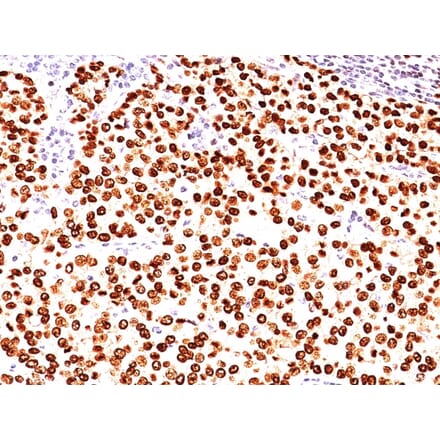 Immunohistochemistry - Anti-Progesterone Receptor Antibody [SPM566] - BSA and Azide free (A252795) - Antibodies.com