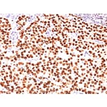 Immunohistochemistry - Anti-Progesterone Receptor Antibody [SPM566] - BSA and Azide free (A252795) - Antibodies.com