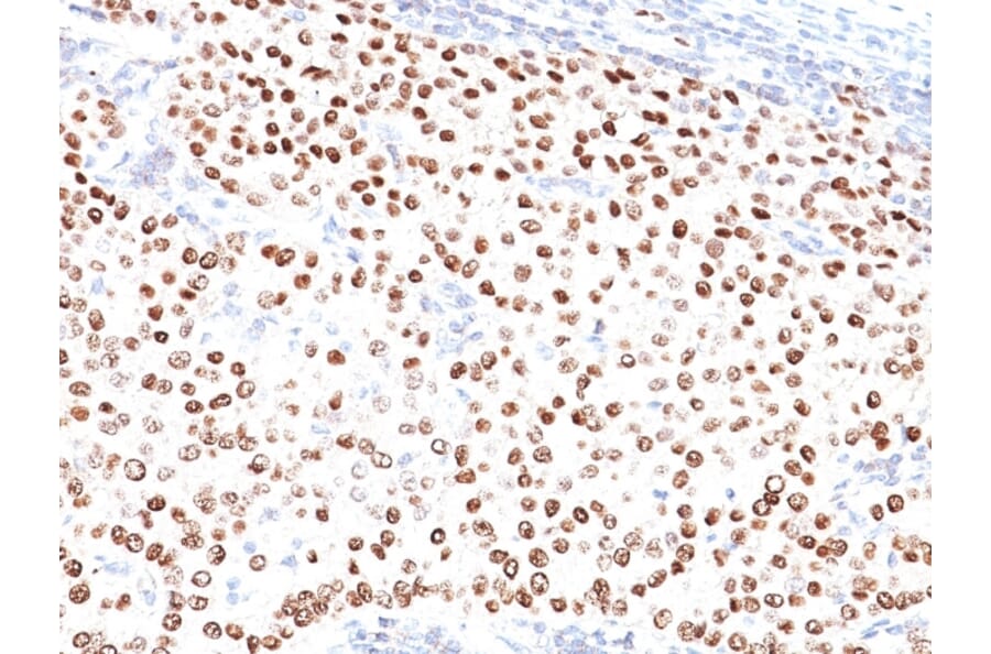 Immunohistochemistry - Anti-Progesterone Receptor Antibody [PR500] - BSA and Azide free (A252796) - Antibodies.com