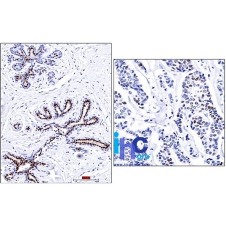 Immunohistochemistry - Anti-Progesterone Receptor Antibody [PR501] - BSA and Azide free (A252797) - Antibodies.com