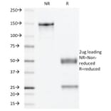 SDS-PAGE - Anti-Progesterone Receptor Antibody [PR501] - BSA and Azide free (A252798) - Antibodies.com