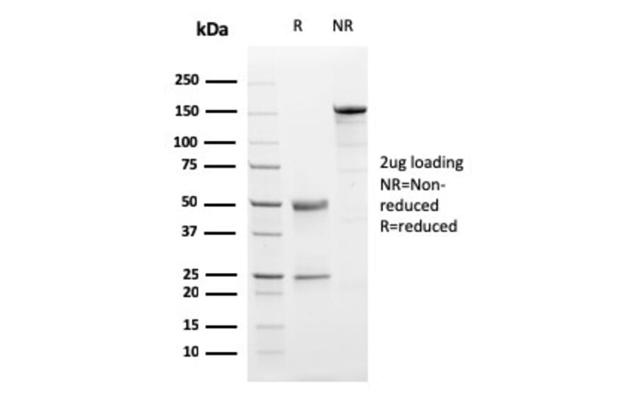 SDS-PAGE - Anti-Progesterone Receptor Antibody [PGR/2694] - BSA and Azide free (A252799) - Antibodies.com