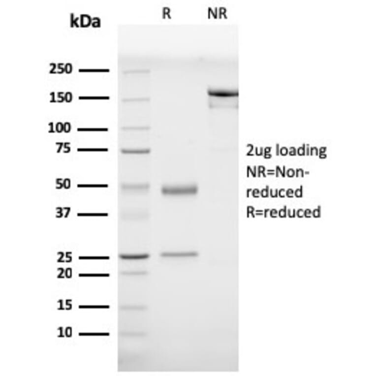 SDS-PAGE - Anti-Prohibitin Antibody [PHB/3230] - BSA and Azide free (A252800) - Antibodies.com