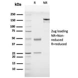 SDS-PAGE - Anti-Prohibitin Antibody [PHB/3230] - BSA and Azide free (A252800) - Antibodies.com