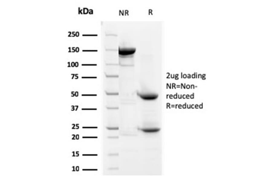 SDS-PAGE - Anti-Prohibitin Antibody [SPM311] - BSA and Azide free (A252803) - Antibodies.com