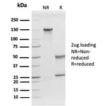 SDS-PAGE - Anti-Prohibitin Antibody [PHB/1882] - BSA and Azide free (A252804) - Antibodies.com
