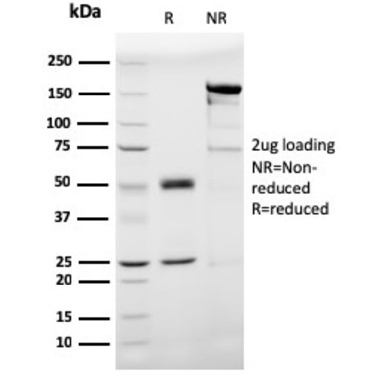 SDS-PAGE - Anti-Prohibitin Antibody [PHB/3193] - BSA and Azide free (A252805) - Antibodies.com