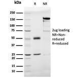 SDS-PAGE - Anti-Prohibitin Antibody [PHB/3193] - BSA and Azide free (A252805) - Antibodies.com