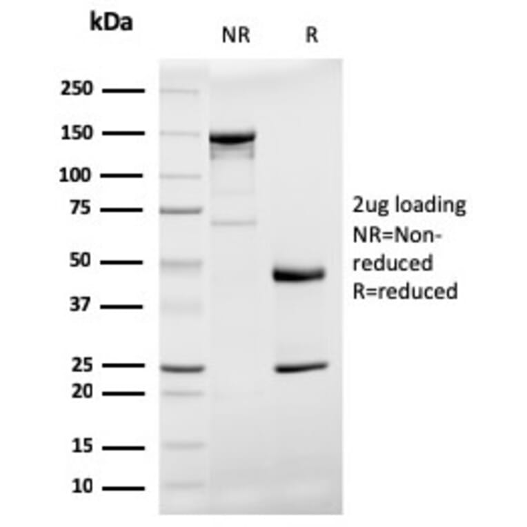 SDS-PAGE - Anti-Prohibitin Antibody [PHB/3194] - BSA and Azide free (A252806) - Antibodies.com