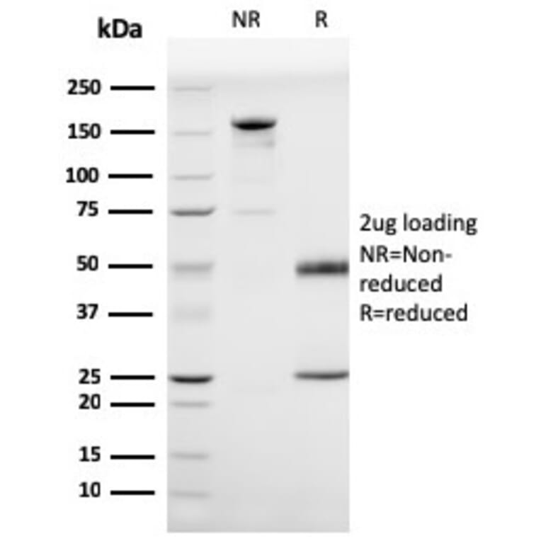 SDS-PAGE - Anti-Prohibitin Antibody [PHB/3225] - BSA and Azide free (A252807) - Antibodies.com