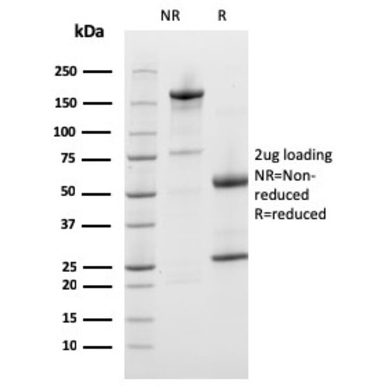 SDS-PAGE - Anti-Prohibitin Antibody [PHB/3226] - BSA and Azide free (A252808) - Antibodies.com