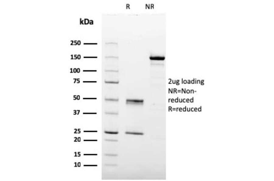 SDS-PAGE - Anti-Prohibitin Antibody [PHB/3227] - BSA and Azide free (A252809) - Antibodies.com