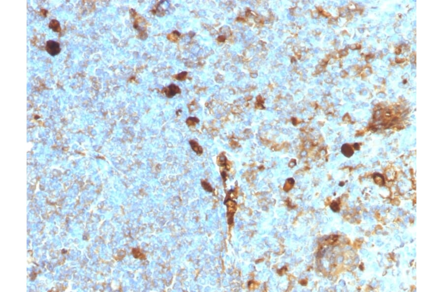 Immunohistochemistry - Anti-alpha 1 Antitrypsin Antibody [AAT/1378] - BSA and Azide free (A252811) - Antibodies.com