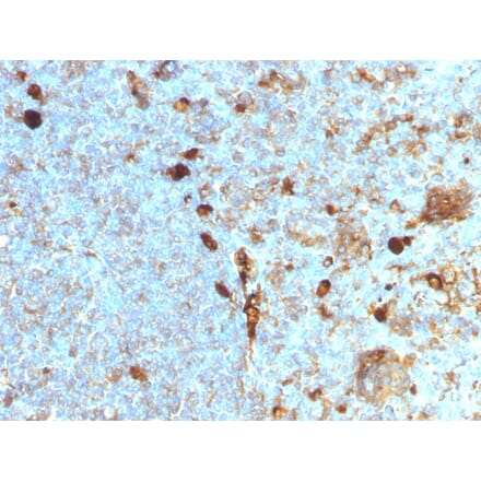 Immunohistochemistry - Anti-alpha 1 Antitrypsin Antibody [AAT/1378] - BSA and Azide free (A252811) - Antibodies.com