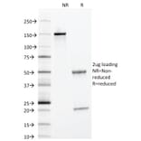 SDS-PAGE - Anti-alpha 1 Antitrypsin Antibody [AAT/1378] - BSA and Azide free (A252812) - Antibodies.com