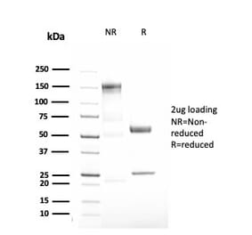 SDS-PAGE - Anti-alpha 1 Antitrypsin Antibody [AAT/3167R] - BSA and Azide free (A252814) - Antibodies.com