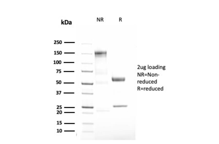 SDS-PAGE - Anti-alpha 1 Antitrypsin Antibody [AAT/3167R] - BSA and Azide free (A252814) - Antibodies.com
