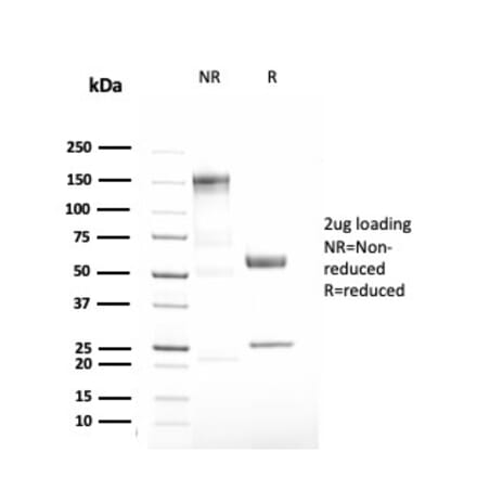 SDS-PAGE - Anti-alpha 1 Antitrypsin Antibody [AAT/3167R] - BSA and Azide free (A252814) - Antibodies.com