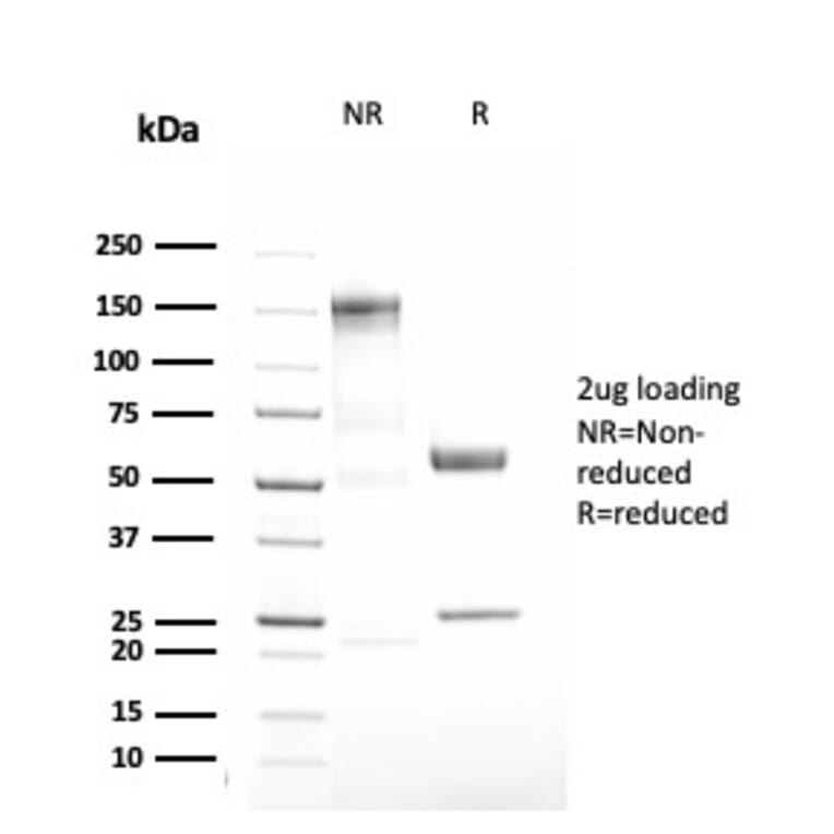 SDS-PAGE - Anti-alpha 1 Antitrypsin Antibody [AAT/3167R] - BSA and Azide free (A252814) - Antibodies.com