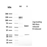 SDS-PAGE - Anti-alpha 1 Antitrypsin Antibody [AAT/3167R] - BSA and Azide free (A252814) - Antibodies.com