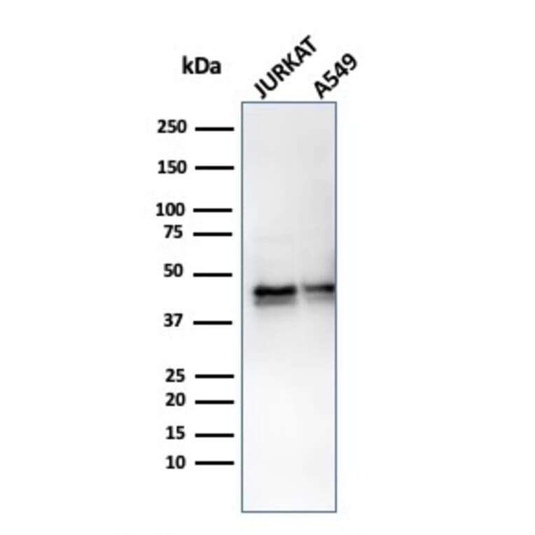 Western Blot - Anti-alpha 1 Antitrypsin Antibody [AAT/3167R] - BSA and Azide free (A252814) - Antibodies.com