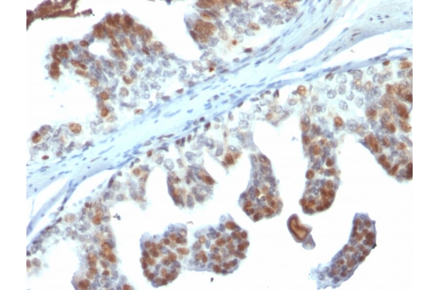 Immunohistochemistry - Anti-PTEN Antibody [PTEN/2110] - BSA and Azide free (A252815) - Antibodies.com