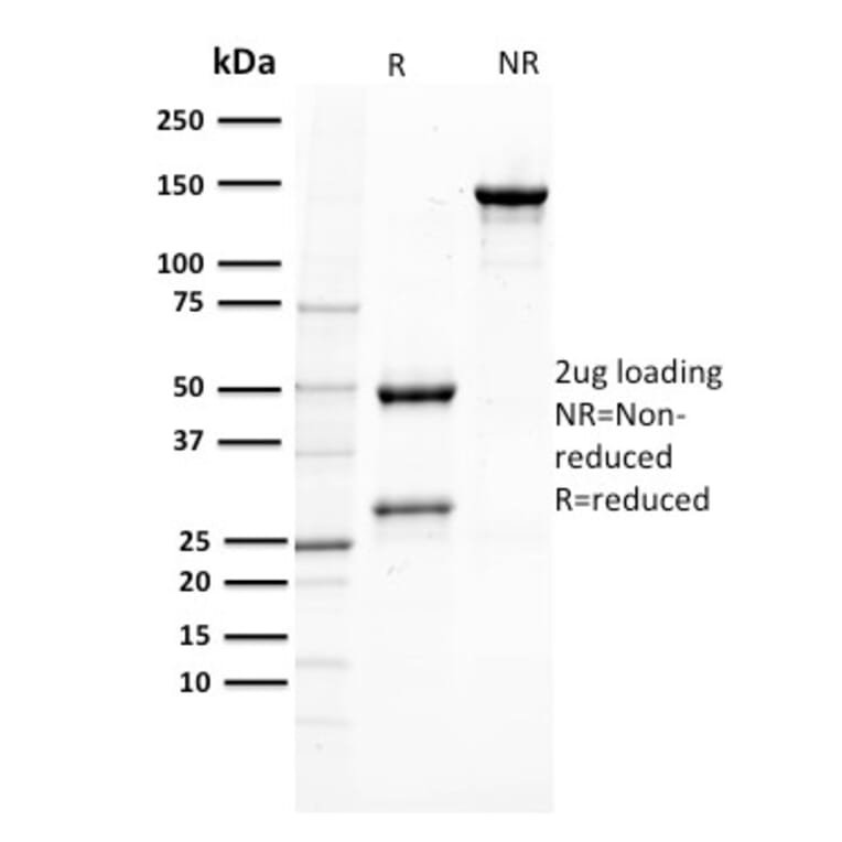 SDS-PAGE - Anti-PTEN Antibody [PTEN/2110] - BSA and Azide free (A252815) - Antibodies.com