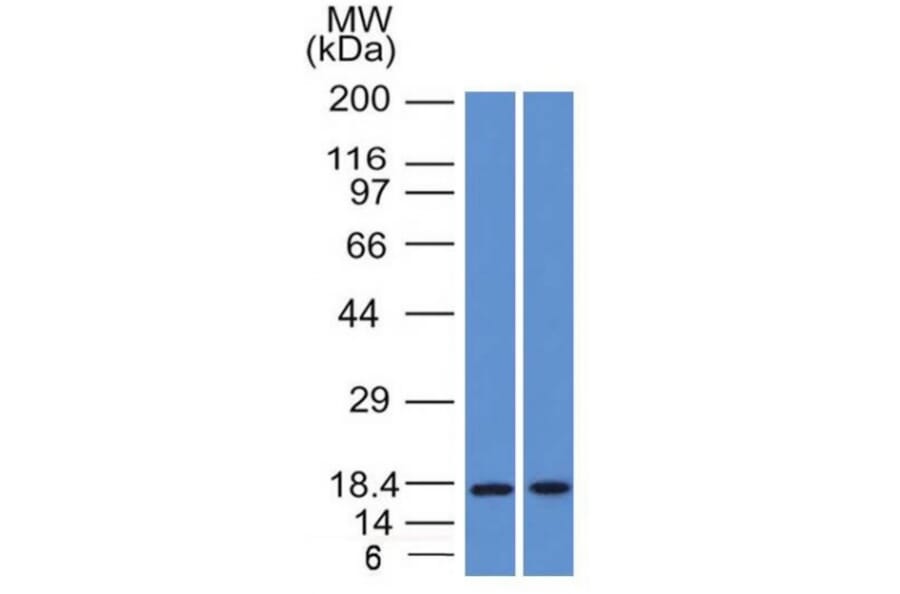 Western Blot - Anti-GCDFP 15 Antibody [PIP/1571] - BSA and Azide free (A252816) - Antibodies.com