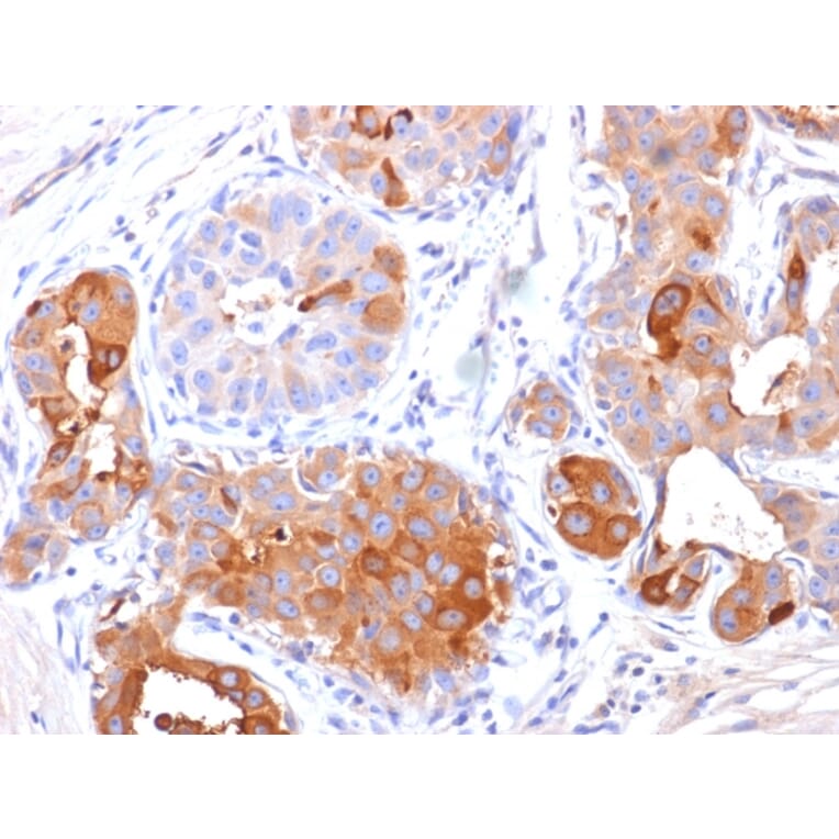 Immunohistochemistry - Anti-GCDFP 15 Antibody [PIP/1571] - BSA and Azide free (A252816) - Antibodies.com