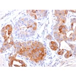 Immunohistochemistry - Anti-GCDFP 15 Antibody [PIP/1571] - BSA and Azide free (A252816) - Antibodies.com